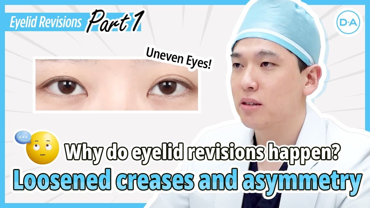 [DA Plastic Surgery Korea] Loosened Creases and Asymmetry Eyes PART 1