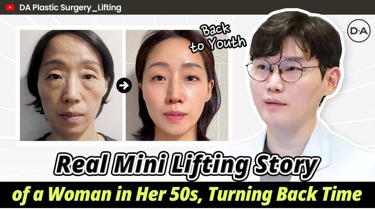 [DA Plastic Surgery Korea] Real Mini Lifting Story From DA