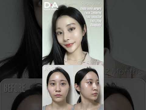 완벽한 얼굴 조화 완성✨